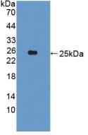 Polyclonal Antibody to CUB Domain Containing Protein 1 (CDCP1)