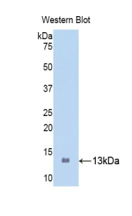 Biotin-Linked Polyclonal Antibody to S100 Calcium Binding Protein A8 (S100A8)