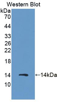 Polyclonal Antibody to S100 Calcium Binding Protein A8 (S100A8)