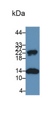 Polyclonal Antibody to S100 Calcium Binding Protein A9 (S100A9)