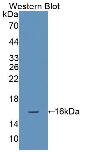 Polyclonal Antibody to Natural Cytotoxicity Triggering Receptor 3 (NCR3)