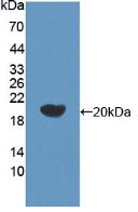 Polyclonal Antibody to Beta Secretase 2 (BACE2)