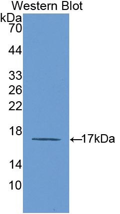Polyclonal Antibody to Interleukin 6 Receptor (IL6R)