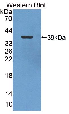 Polyclonal Antibody to Nuclear Factor Kappa B2 (NFkB2)