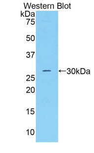 Polyclonal Antibody to Complement Factor D (CFD)