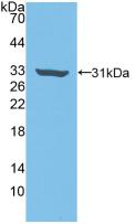 Polyclonal Antibody to Rho Associated Coiled Coil Containing Protein Kinase 2 (Rock2)