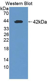 Polyclonal Antibody to Receptor Tyrosine Protein Kinase erbB-2 (ErbB2)