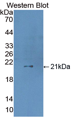 Polyclonal Antibody to Coagulation Factor VII (F7)