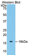Polyclonal Antibody to Cyclin Dependent Kinase 1 (CDK1)