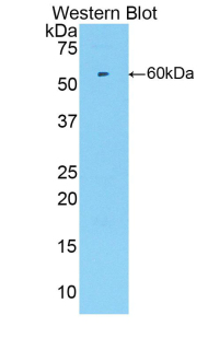 Polyclonal Antibody to Cyclin Dependent Kinase 2 (CDK2)