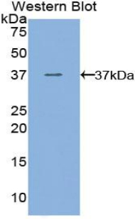 Polyclonal Antibody to Vascular Endothelial Growth Factor Receptor 3 (VEGFR3)