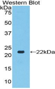 Polyclonal Antibody to Toll Like Receptor 7 (TLR7)
