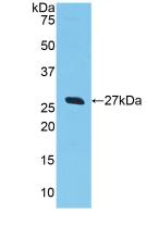 Polyclonal Antibody to Glutathione S Transferase Alpha 2 (GSTa2)