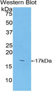 Polyclonal Antibody to Superoxide Dismutase 1 (SOD1)
