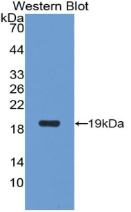 Polyclonal Antibody to Superoxide Dismutase 1 (SOD1)