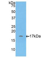 Polyclonal Antibody to A Disintegrin And Metalloproteinase With Thrombospondin 7 (ADAMTS7)