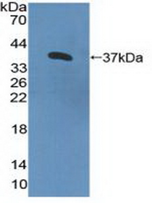 Polyclonal Antibody to Interleukin 8 Receptor Beta (IL8Rb)