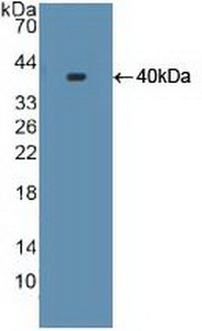 Polyclonal Antibody to Cytochrome P450 17A1 (CYP17A1)