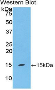 Polyclonal Antibody to S100 Calcium Binding Protein A7 (S100A7)