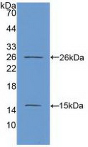 Polyclonal Antibody to Ki-67 Protein (Ki-67)