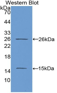 Biotin-Linked Polyclonal Antibody to Ki-67 Protein (Ki-67)