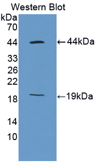 Polyclonal Antibody to Ki-67 Protein (Ki-67)