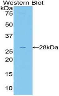 Polyclonal Antibody to Fibroblast Growth Factor Receptor Substrate 2 (FRS2)