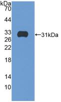 Polyclonal Antibody to Integrin Beta 5 (ITGb5)