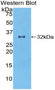 Polyclonal Antibody to Growth Differentiation Factor 11 (GDF11)
