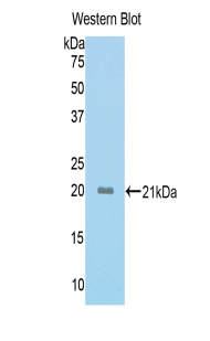 Polyclonal Antibody to Activin A Receptor Type II A (ACVR2A)