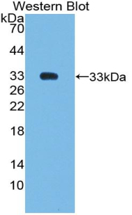 Polyclonal Antibody to SMAD family member 6 (SMAD6)
