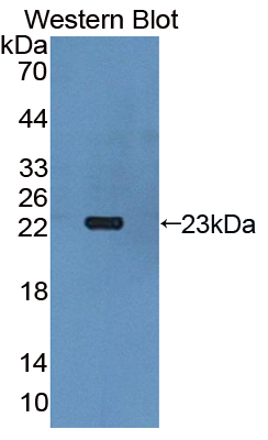 Biotin-Linked Polyclonal Antibody to Gremlin 1 (GREM1)