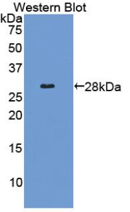 Polyclonal Antibody to Collagen Type IV Alpha 2 (COL4a2)
