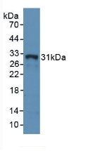 Polyclonal Antibody to HLA Class II Histocompatibility Antigen, DR Alpha Chain (HLA-DRA)