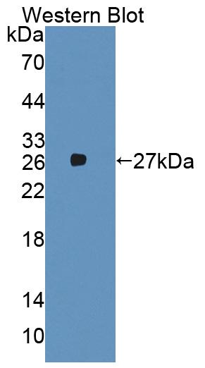 Polyclonal Antibody to Host Cell Factor C1 (HCFC1)