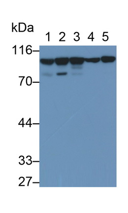 Polyclonal Antibody to Actinin Alpha 4 (ACTN4)
