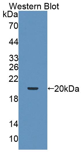 Polyclonal Antibody to Tripartite Motif Containing Protein 3 (TRIM3)