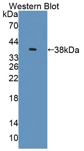 Polyclonal Antibody to Atrophin 1 (ATN1)