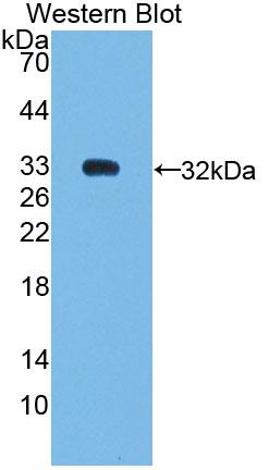 Polyclonal Antibody to Nuclear Receptor Subfamily 0,Group B,Member 2 (NR0B2)