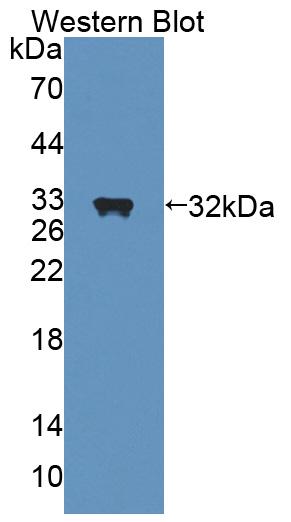 Polyclonal Antibody to Nuclear Receptor Subfamily 0,Group B,Member 2 (NR0B2)