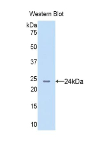Polyclonal Antibody to Anterior Gradient 2 (AGR2)