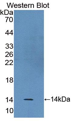 Polyclonal Antibody to Barrier To Autointegration Factor 1 (BANF1)