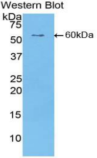 Polyclonal Antibody to Cartilage Intermediate Layer Protein (CILP)