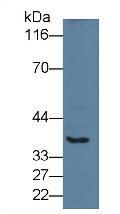 Polyclonal Antibody to Cathepsin E (CTSE)