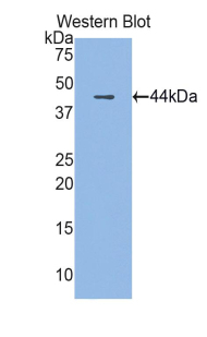 Polyclonal Antibody to Cathelicidin Antimicrobial Peptide (CAMP)