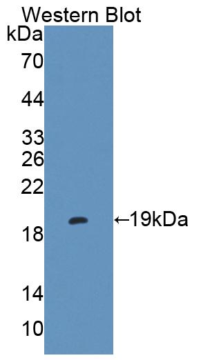 Polyclonal Antibody to Endoplasmic Reticulum Protein 29 (ERP29)