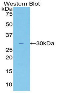 Polyclonal Antibody to Fatty Acid Synthase (FASN)