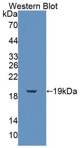 Polyclonal Antibody to FK506 Binding Protein 2 (FKBP2)