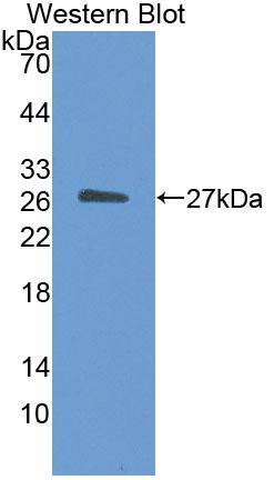 Polyclonal Antibody to Germ Cell Nuclear Factor (GCNF)