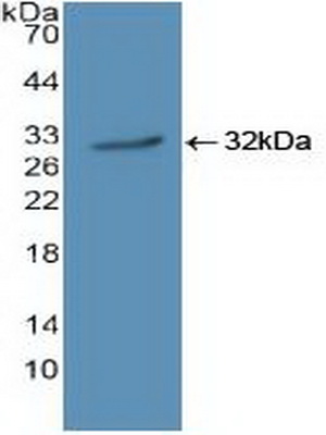 Polyclonal Antibody to Janus Kinase 1 (JAK1)